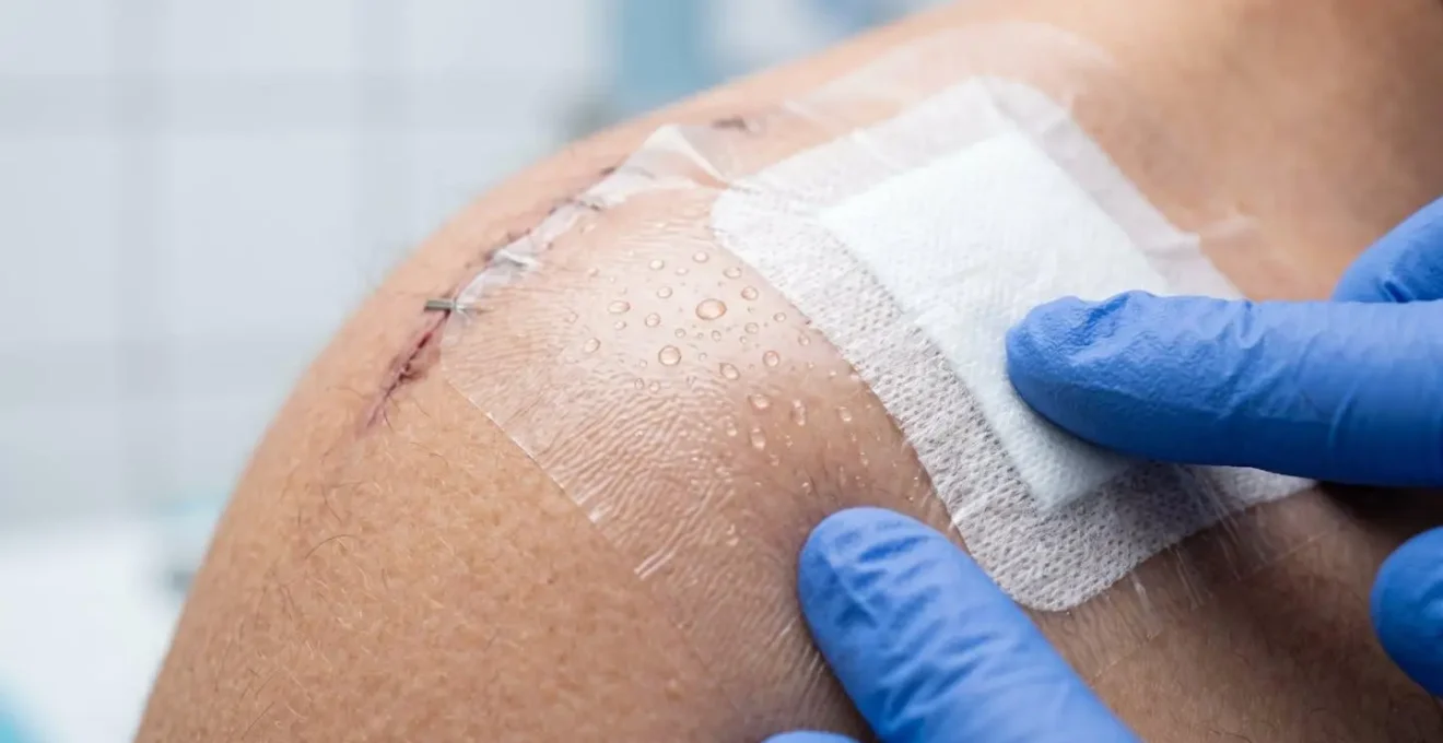 Dimostrazione metodi sicuri per l'igiene senza bagnare le medicazioni