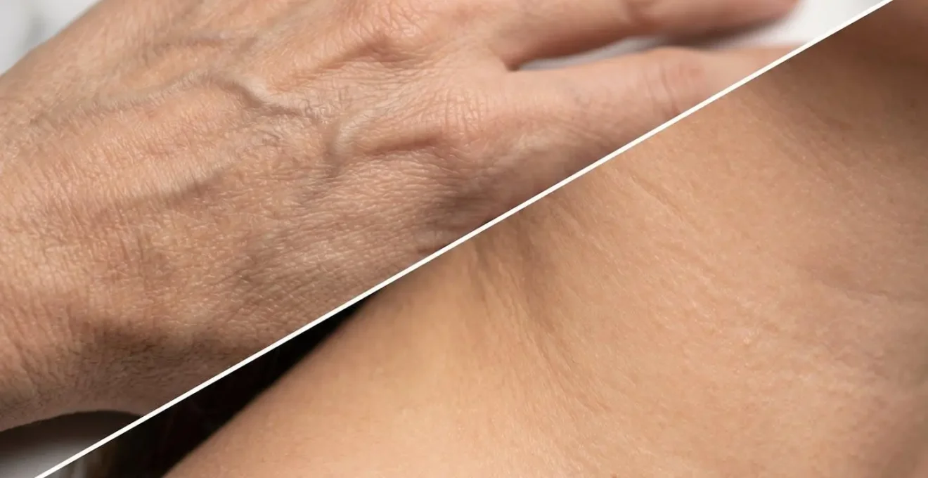 Dettaglio macro della pelle del collo e delle mani prima e dopo il trattamento bioristrutturante